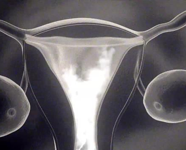 Painless HSG treatment in kolkata - IHR Kolkata