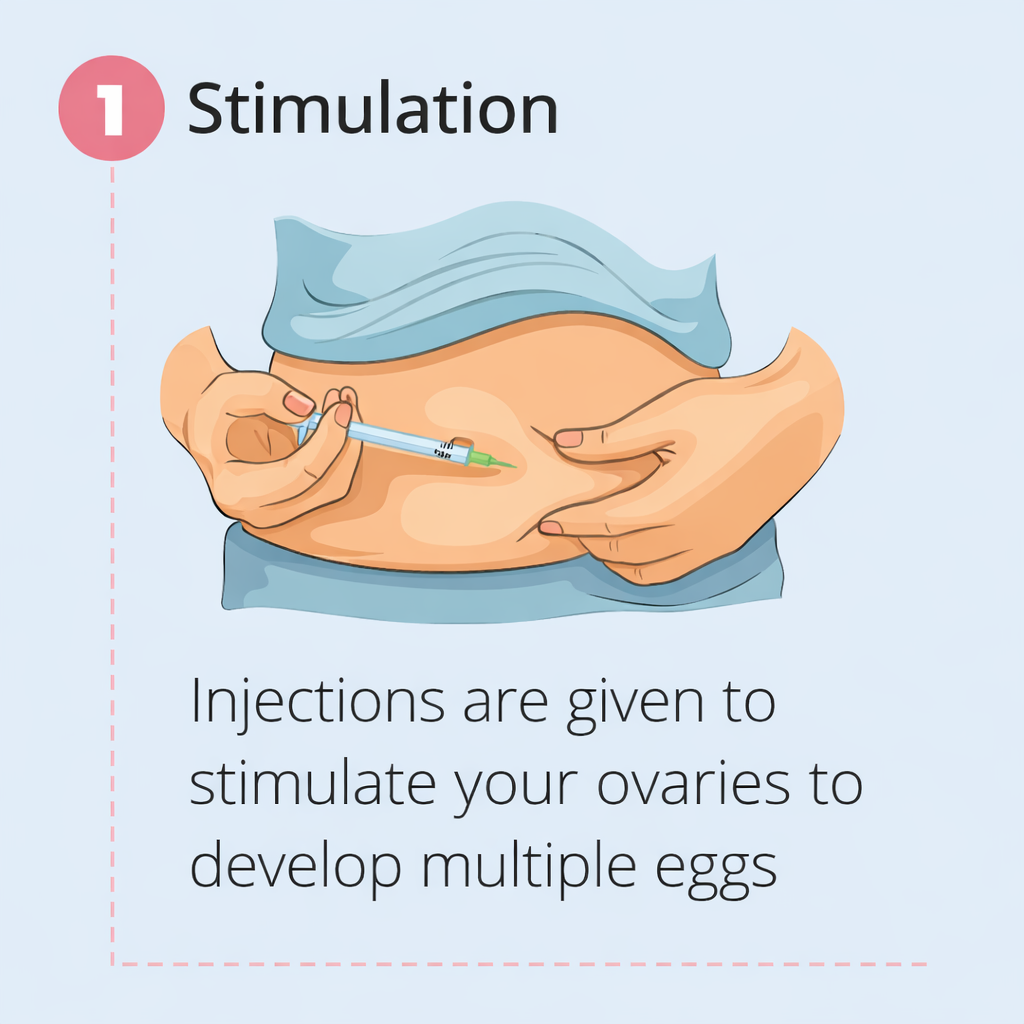 Step 1 Ovarian stimulation